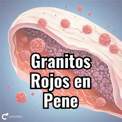 granitos en el oene|Granos en el pene: 10 tipos ofensivos e inofensivos